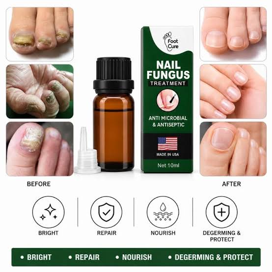 Foot Cure Nail Fungus Treatment – Anti-Microbial & Antiseptic Nail Repair Oil for Toenail & Fingernail Fungus | 10ml
