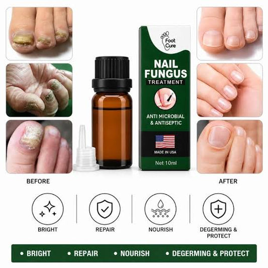 Foot Cure Nail Fungus Treatment – Anti-Microbial & Antiseptic Nail Repair Oil for Toenail & Fingernail Fungus | 10ml