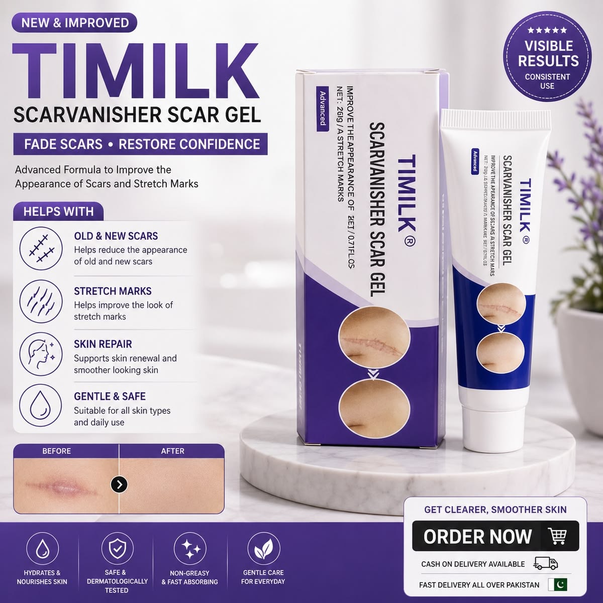TIMILK ScarVanisher Gel fades old & new scars and stretch marks. Gentle, non-greasy formula for smoother, clearer skin with daily use