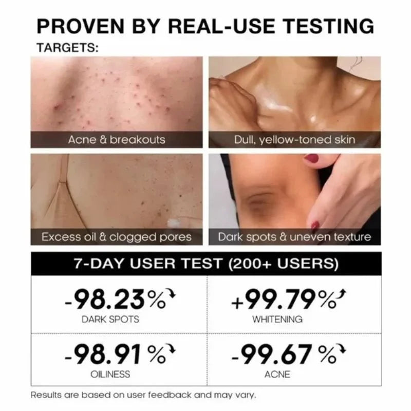 TeaShell Niacinamide Skin Brightening Soap with Alpha-Arbutin & Tranexamic Acid delivers powerful whitening for smoother, even-toned skin. 100g.