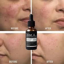 TeaShell Brightening Serum – Reduces Hyperpigmentation, Refines Pores & Strengthens Skin Barrier | Even Tone Face Serum