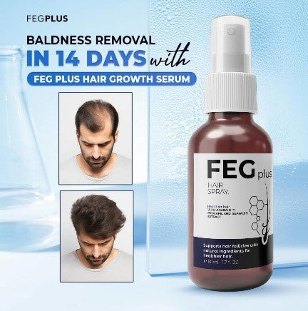 1FEG Plus Hair Growth Spray 50ml | Anti-Hair Loss & Regrowth Solution